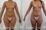Body of two halves?