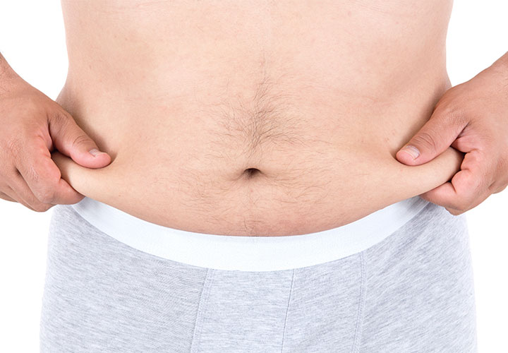 Male liposuction love handles
