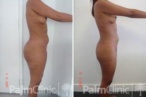 improved waist makes the buttocks look small
